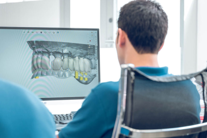 dentist lucru cu dinti digitali radiografie dentara