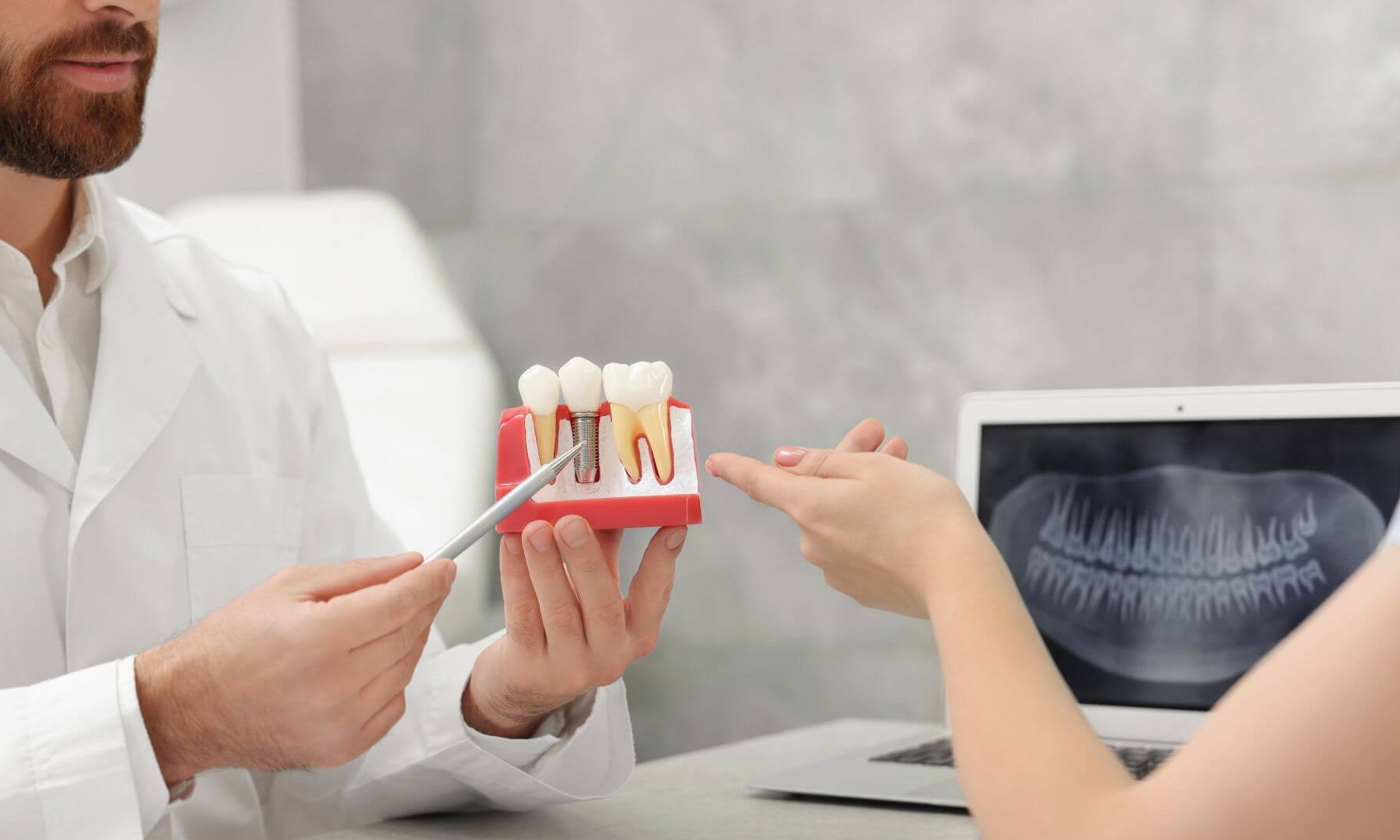 durata implant dentar