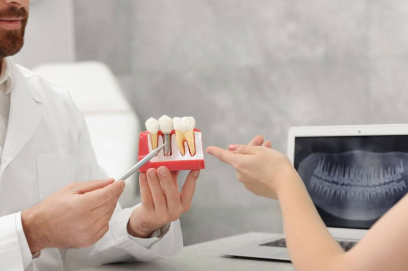 durata implant dentar