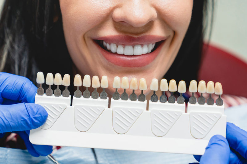 fatete dentare in rate