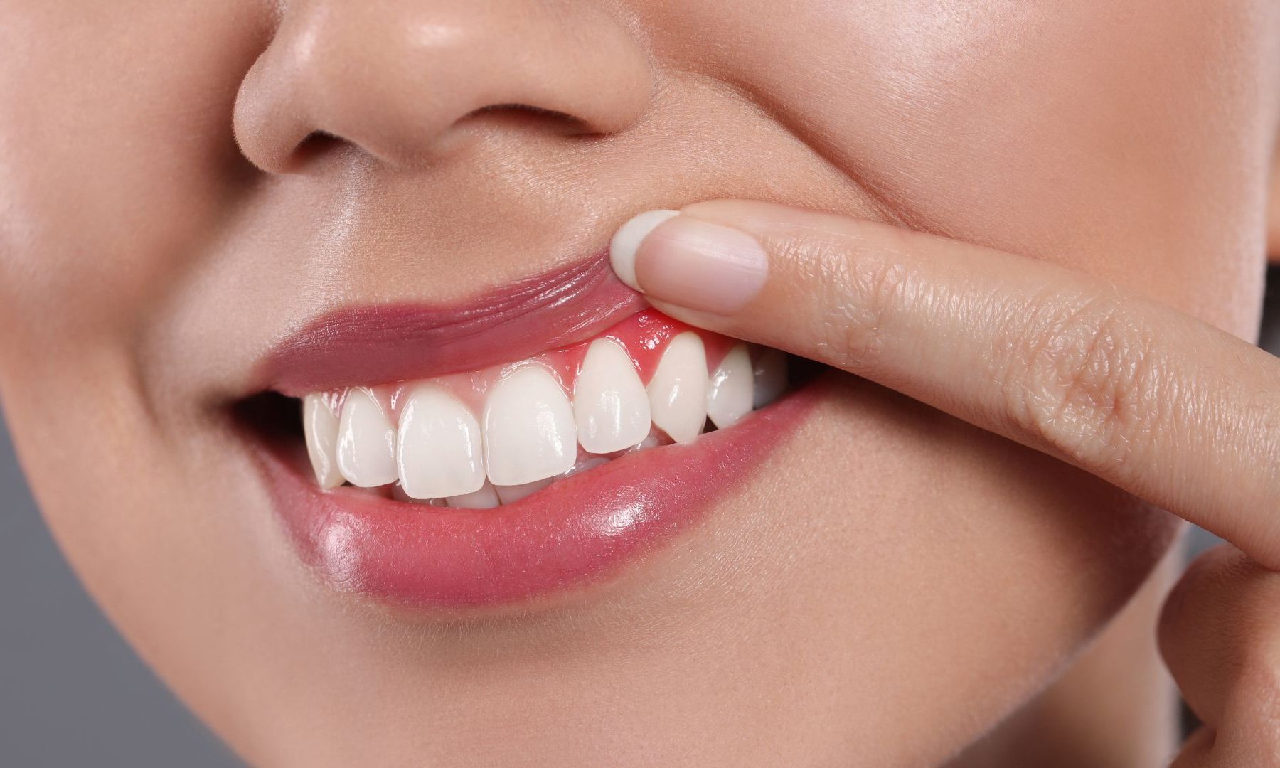 gingii inflamate si dureroase