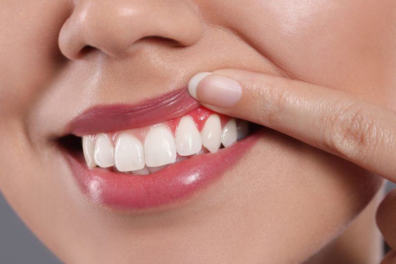 gingii inflamate si dureroase