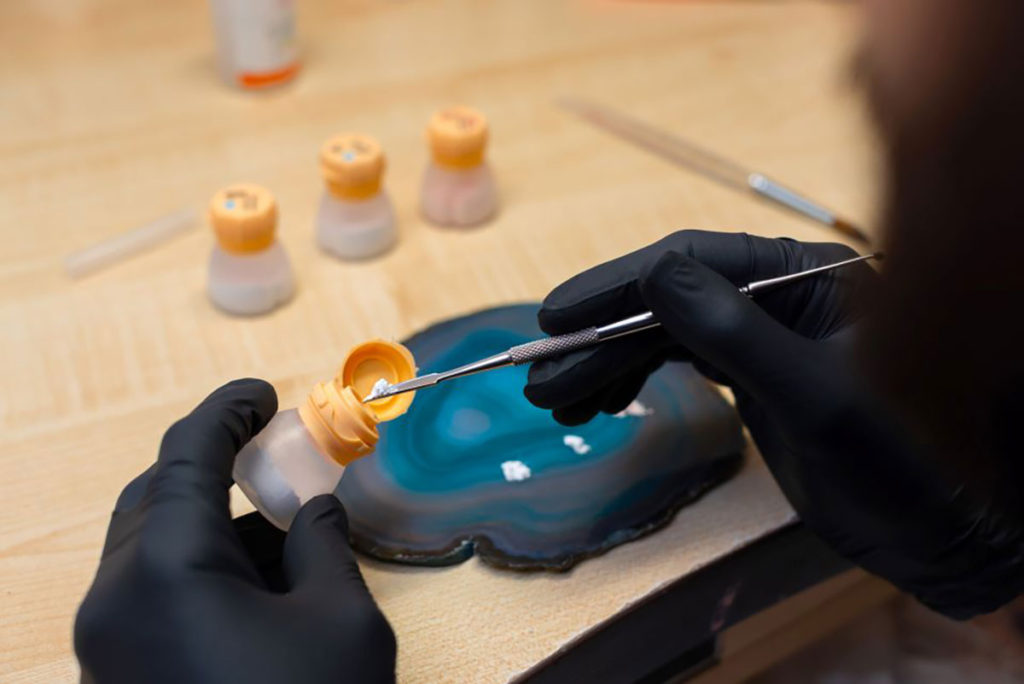 dentist incrustatii dentare