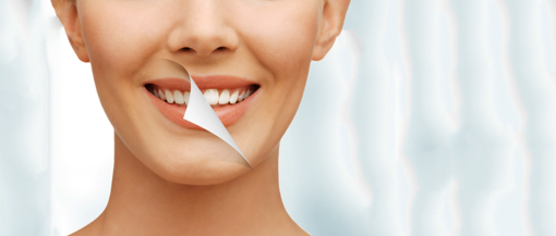 tratament albire dinti