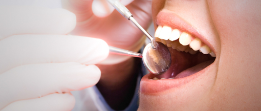 femeie la dentist control