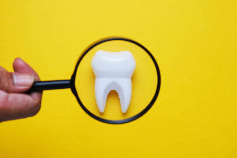 dinte sub lupa pe fundal galben