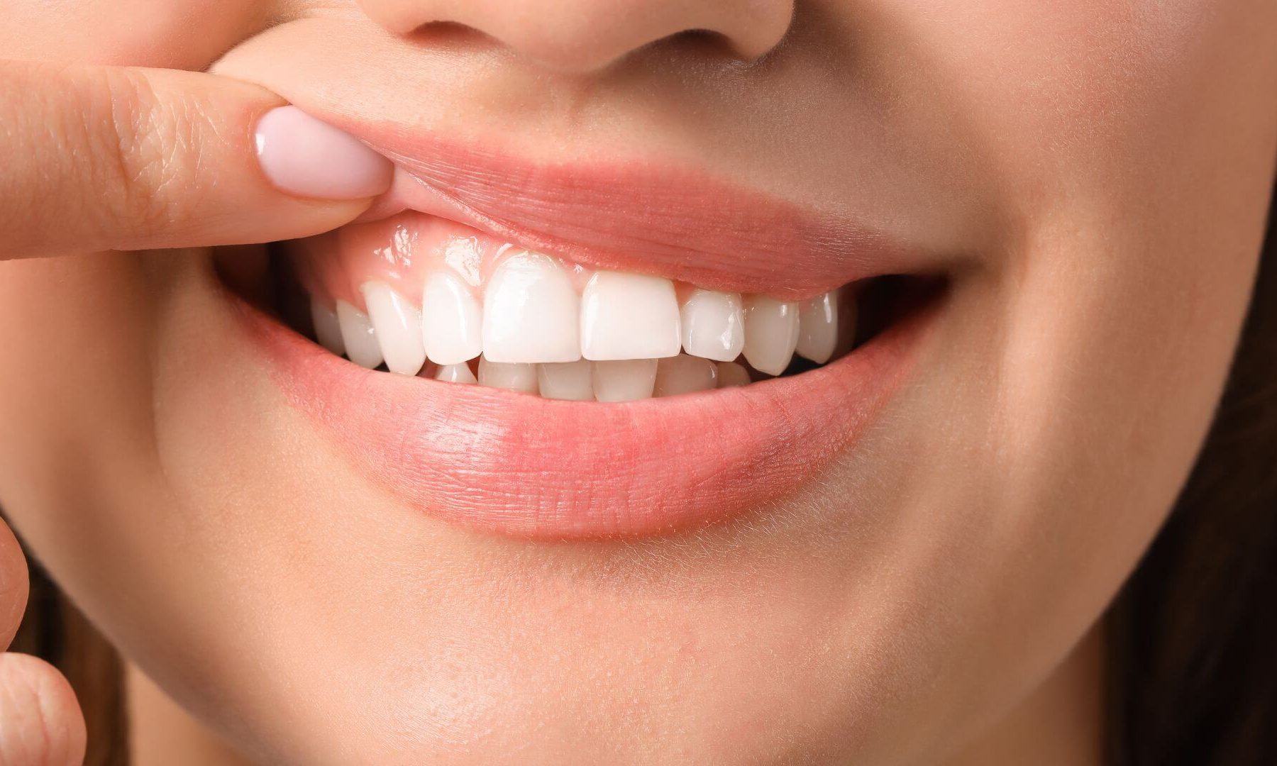 vindecarea gingiei dupa implant