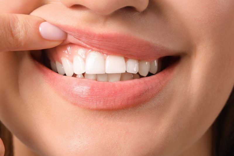 vindecarea gingiei dupa implant